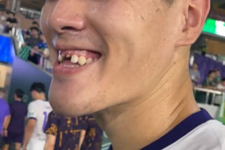 😨太惨了！津门虎0-2不敌浙江，中卫王献均门牙在比赛中被撞掉